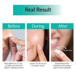 SOME BY MI Clear Spot Patch 18 Patches - Image 2